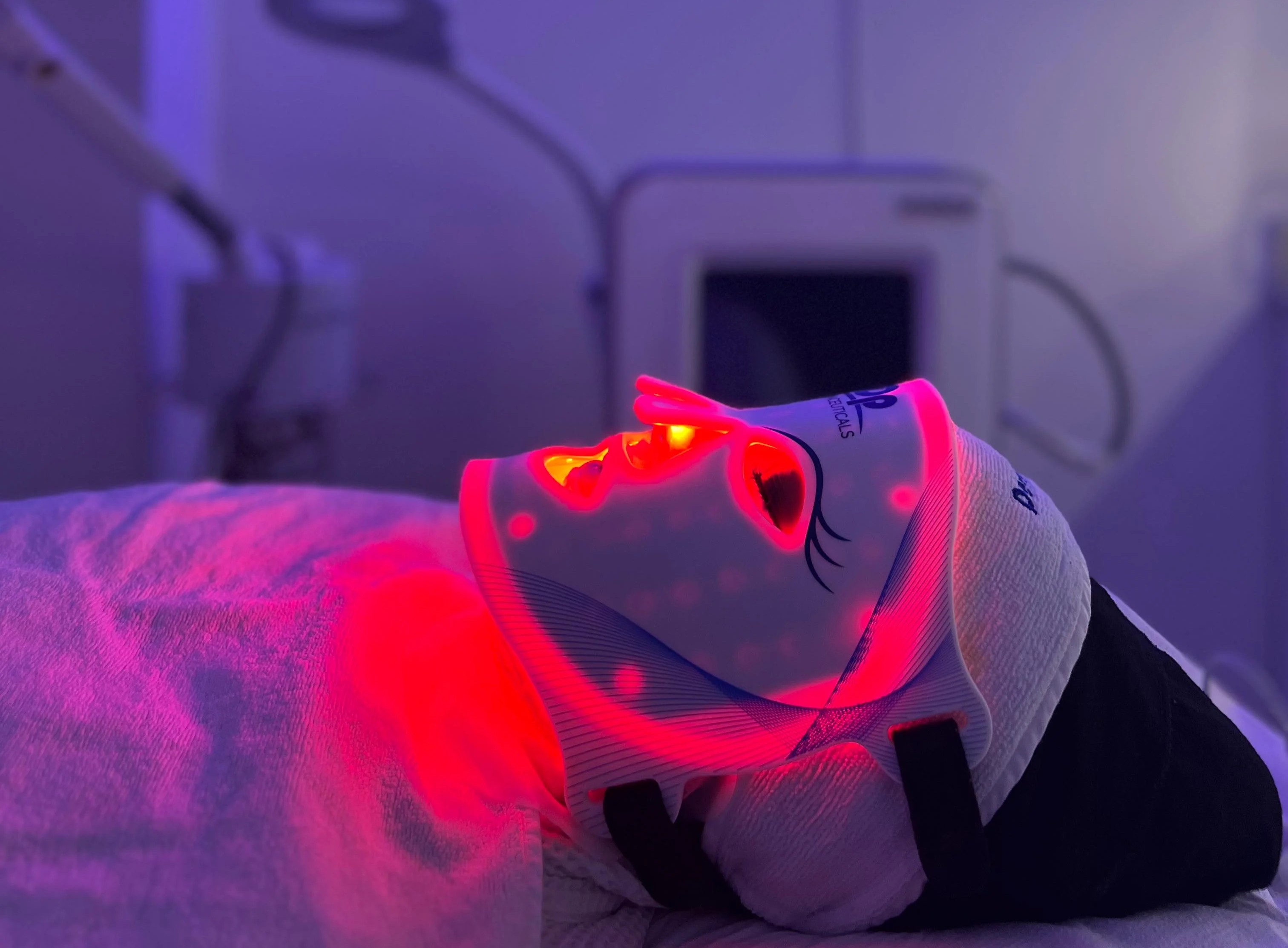 Blue LED light therapy after microneedling